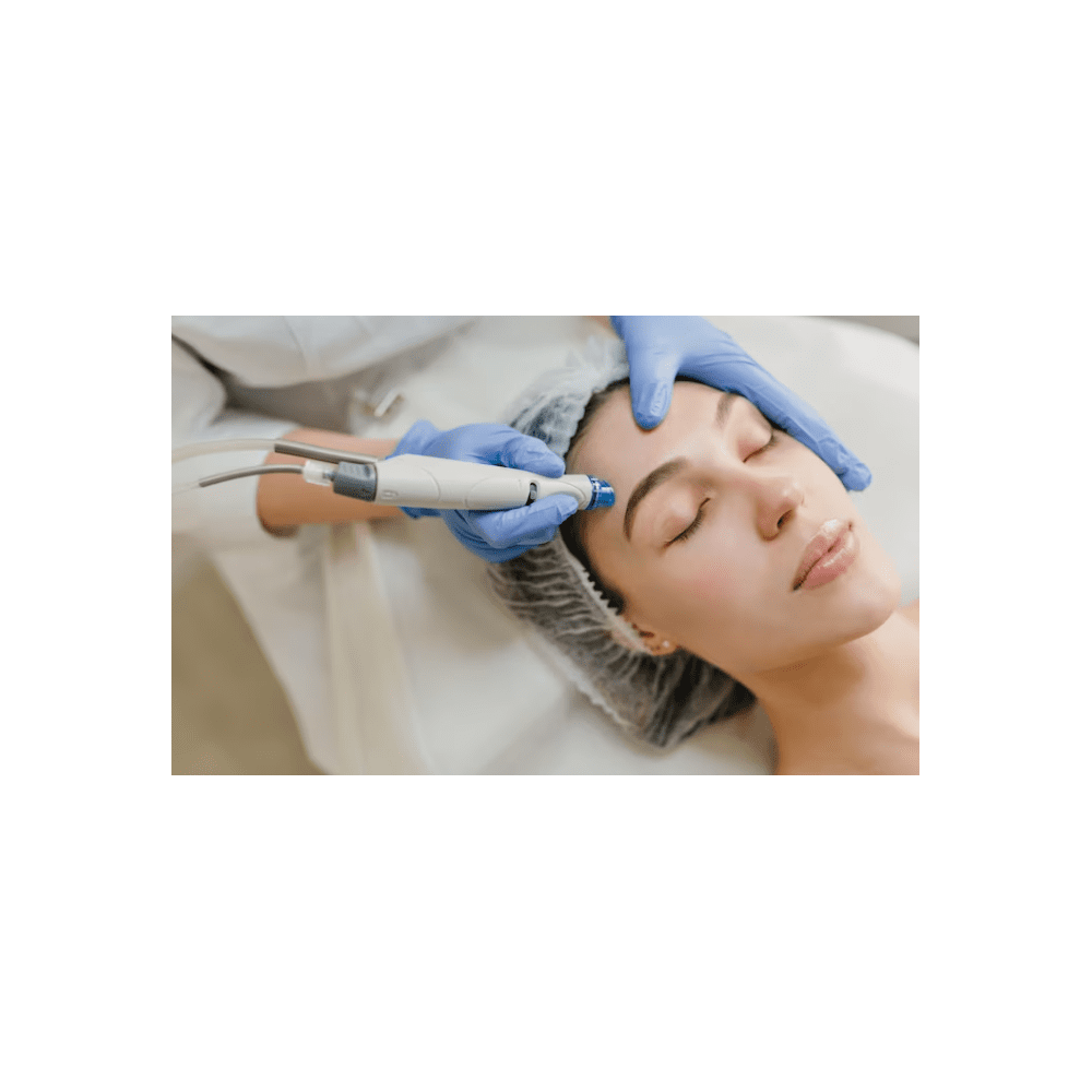 Micro-needling