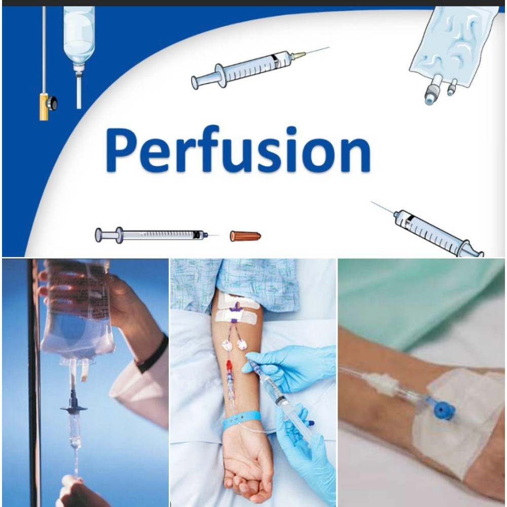 Perfusions 